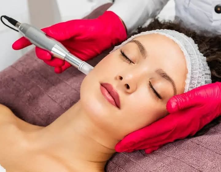 Microneedling Gratis Behandlung Model gesucht