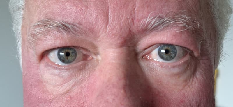 Antiaging durch Bio Fasziale Behandlung