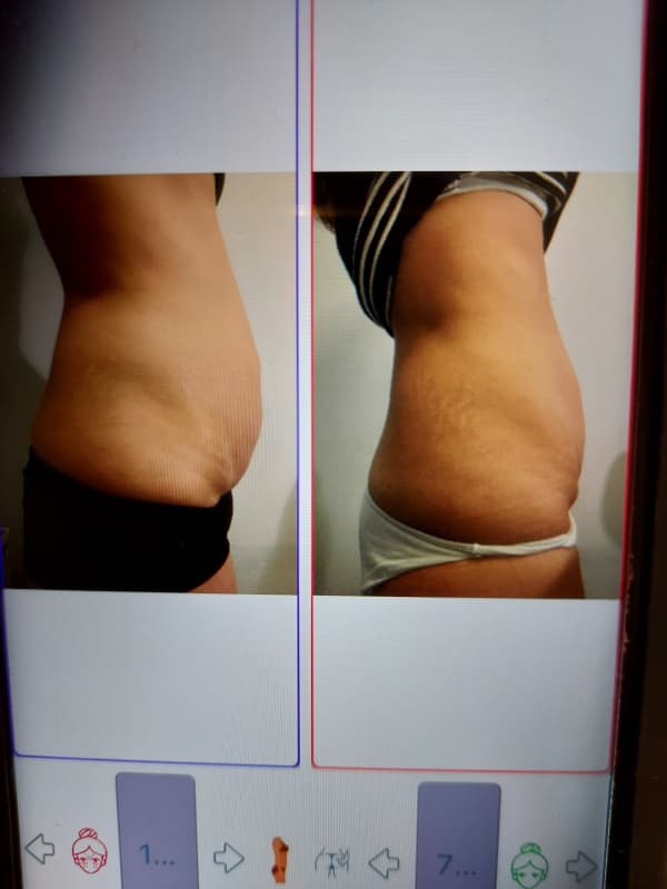Revolutionären Figurkonzepts „BODY SHAPE“ Ihrer Traumfigur näher