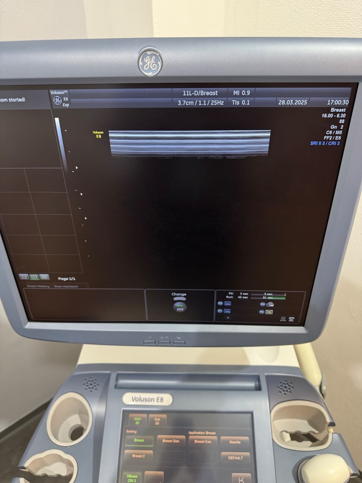 GE Voluson E8 Ultraschallgerät Gynäkologie